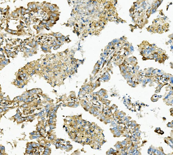 Hexokinase 1/HK1 Mouse Monoclonal Antibody