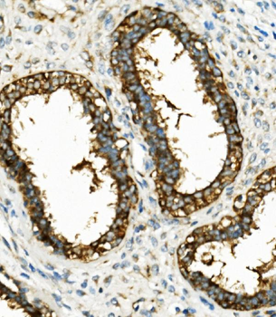 Hexokinase 1/HK1 Mouse Monoclonal Antibody
