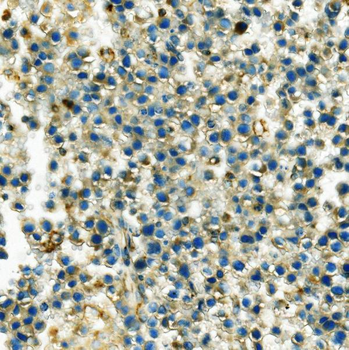 Hexokinase 1/HK1 Mouse Monoclonal Antibody