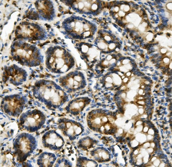 Hexokinase 1/HK1 Mouse Monoclonal Antibody