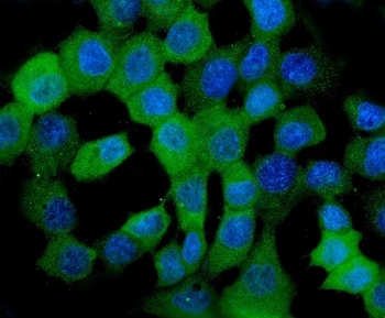 HSPB8/Hsp22 Mouse Monoclonal Antibody