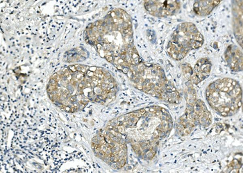 BubR1/BUB1B Mouse Monoclonal Antibody