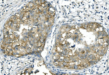 BubR1/BUB1B Mouse Monoclonal Antibody