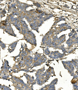 BubR1/BUB1B Mouse Monoclonal Antibody