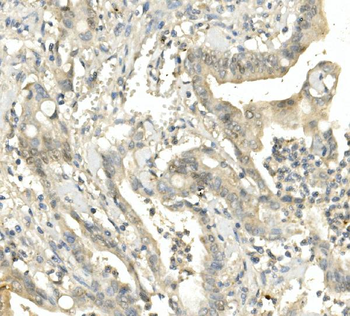 BubR1/BUB1B Mouse Monoclonal Antibody