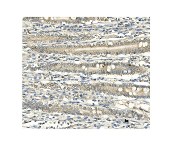 BubR1/BUB1B Mouse Monoclonal Antibody