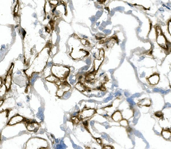 CD31/PECAM1 Mouse Monoclonal Antibody