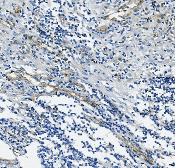 CD31/PECAM1 Mouse Monoclonal Antibody