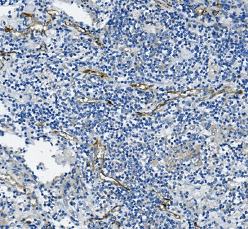 CD31/PECAM1 Mouse Monoclonal Antibody