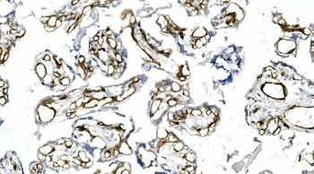 CD146/MCAM Mouse Monoclonal Antibody