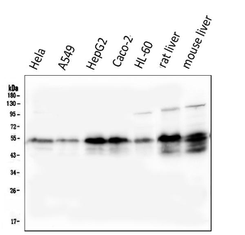 Retinoid X Receptor alpha/RXRA Mouse Monoclonal Antibody