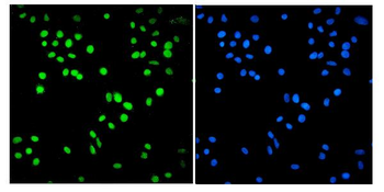 SMARCA2/BRM Mouse Monoclonal Antibody