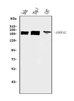 SMARCA2/BRM Mouse Monoclonal Antibody