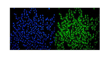 SMARCA2/BRM Mouse Monoclonal Antibody