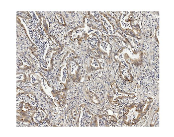Methylmalonyl Coenzyme A mutase Mouse Monoclonal Antibody