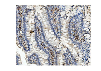 Methylmalonyl Coenzyme A mutase Mouse Monoclonal Antibody