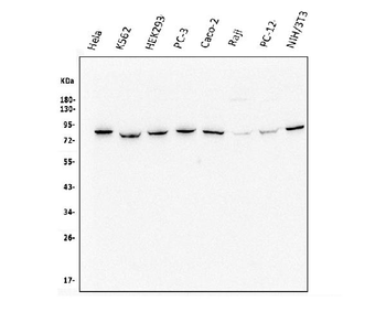 Methylmalonyl Coenzyme A mutase Mouse Monoclonal Antibody