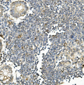 Bid Mouse Monoclonal Antibody