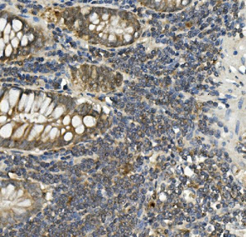 Bid Mouse Monoclonal Antibody