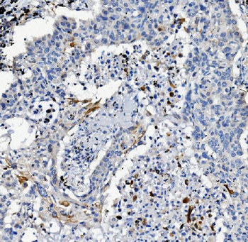 ATG7 Rabbit Polyclonal Antibody