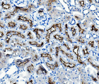ATG7 Rabbit Polyclonal Antibody