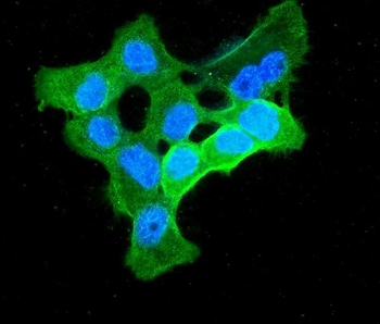 ENO1 Rabbit Polyclonal Antibody