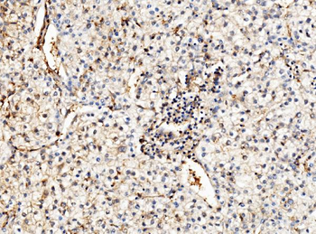 ENO1 Rabbit Polyclonal Antibody