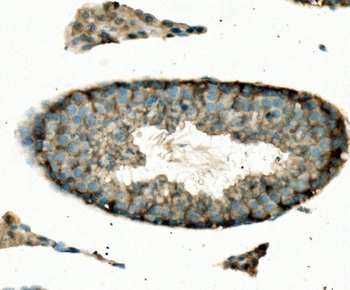 ENO1 Rabbit Polyclonal Antibody