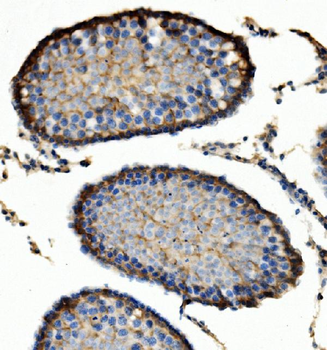 ENO1 Rabbit Polyclonal Antibody