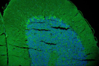 GAP43 Rabbit Polyclonal Antibody