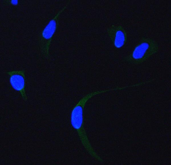 SDHA Rabbit Polyclonal Antibody