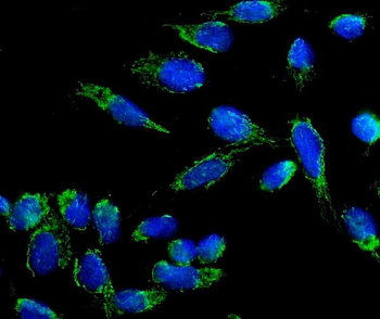 beta 3 Adrenergic Receptor/ADRB3 Rabbit Polyclonal Antibody