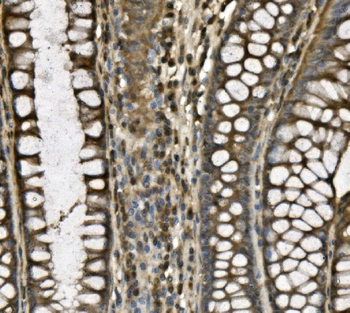 CD239/BCAM Rabbit Polyclonal Antibody