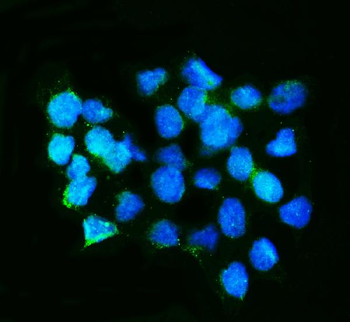 Calretinin/CALB2 Rabbit Polyclonal Antibody