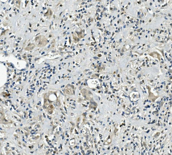 Calretinin/CALB2 Rabbit Polyclonal Antibody