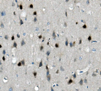 Calretinin/CALB2 Rabbit Polyclonal Antibody
