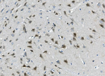Calretinin/CALB2 Rabbit Polyclonal Antibody