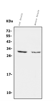 Calretinin/CALB2 Rabbit Polyclonal Antibody