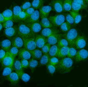 CaMKII alpha/CAMK2A Rabbit Polyclonal Antibody