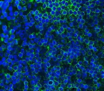 Cd79a Rabbit Polyclonal Antibody