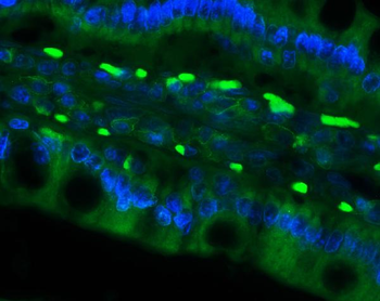 Cd79a Rabbit Polyclonal Antibody