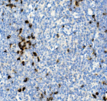 Cd79a Rabbit Polyclonal Antibody
