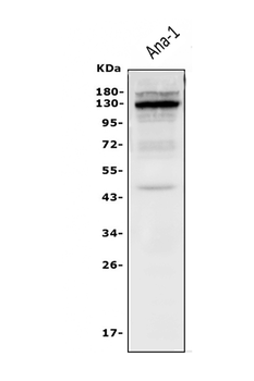 IL-3RB/Csf2rb/IL Rabbit Polyclonal Antibody
