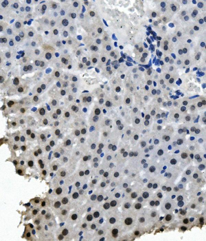 RNA Helicase A/DHX9 Rabbit Polyclonal Antibody