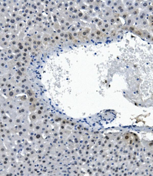 RNA Helicase A/DHX9 Rabbit Polyclonal Antibody