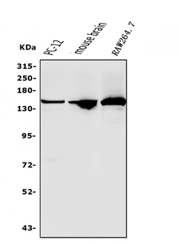RNA Helicase A/DHX9 Rabbit Polyclonal Antibody