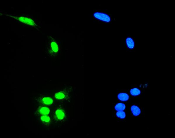 RNA Helicase A/DHX9 Rabbit Polyclonal Antibody