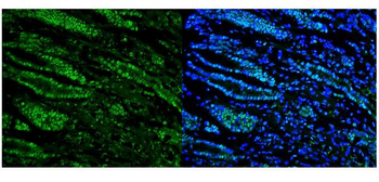 RNA Helicase A/DHX9 Rabbit Polyclonal Antibody