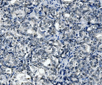 RNA Helicase A/DHX9 Rabbit Polyclonal Antibody