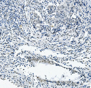 RNA Helicase A/DHX9 Rabbit Polyclonal Antibody